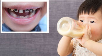 乳牙期口腔護(hù)理的重要性 別讓疏忽影響恒牙健康